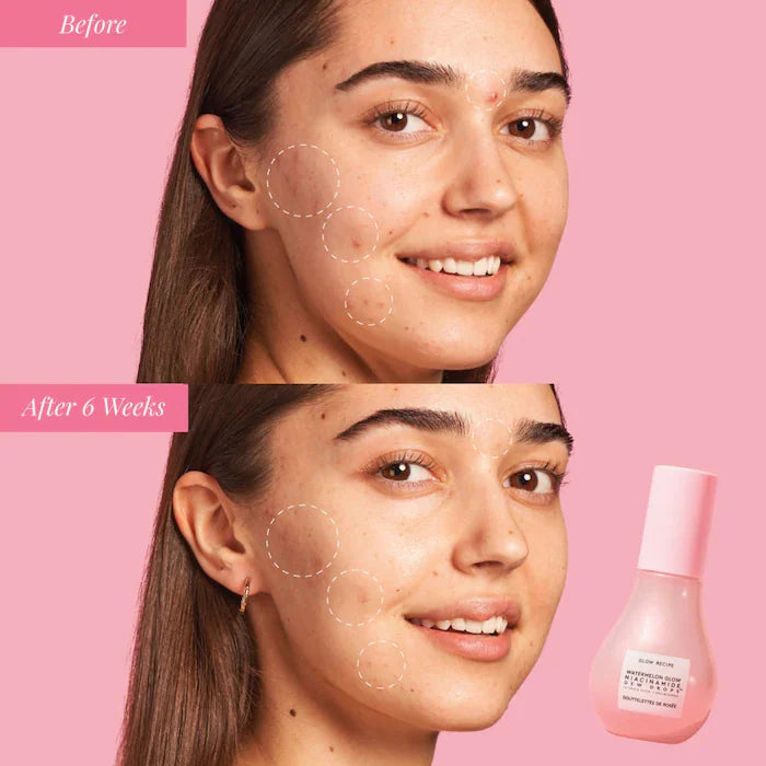 Sephora Favorites The Glow Up Kit - מארז מוצרים ספורה