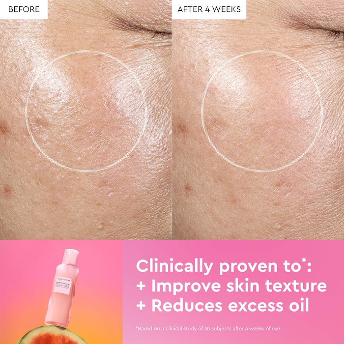 Glow Recipe Watermelon Glow PHA + BHA Pore-Tight Toner - טונר גלואו רספי אריזה מהדורה מיוחדת גאווה - החנות שמוכרת את מוצרי ספורה בארץ