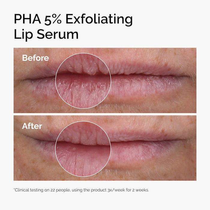 The Ordinary PHA 5% Exfoliating Lip Serum - סרום פילינג עדין לשפתיים דה אורדינרי - החנות שמוכרת את מוצרי ספורה בארץ