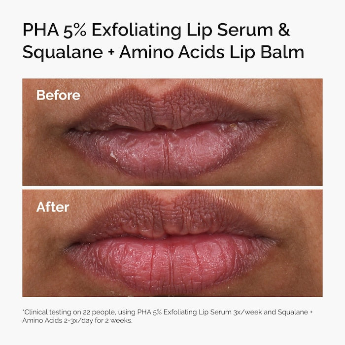 The Ordinary PHA 5% Exfoliating Lip Serum - סרום פילינג עדין לשפתיים דה אורדינרי - החנות שמוכרת את מוצרי ספורה בארץ